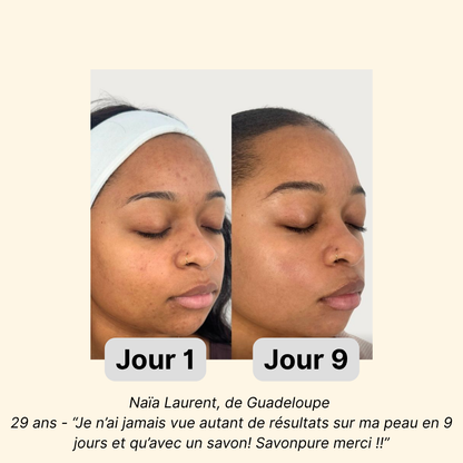 Savon anti-tâches au curcuma - 100% Bio et Naturel